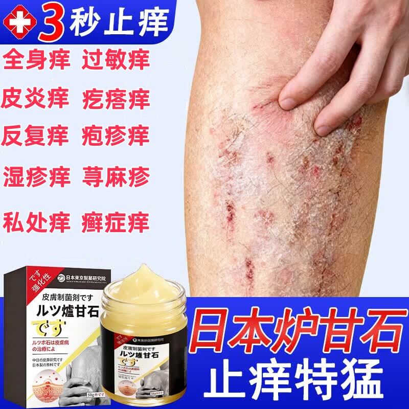 止痒特效药皮肤湿瘙痒疹去外用苗家湿毒膏进口正品专用抑菌乳膏