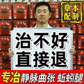 静脉曲张冷敷凝胶专用膏静脉曲张专用药青筋凸起特效疗治非