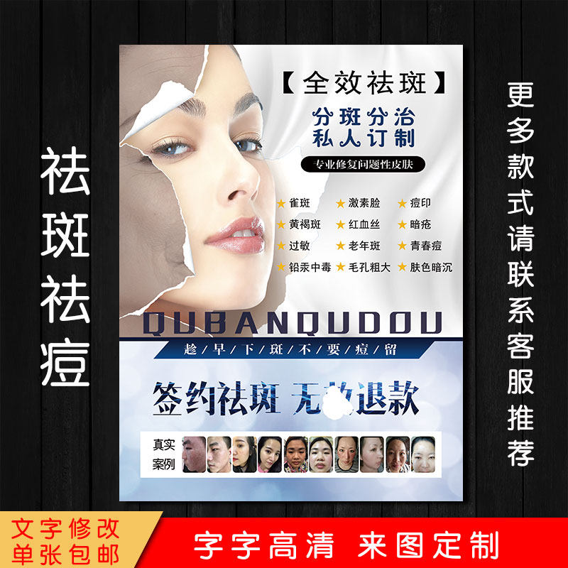 美容院专业祛斑淡斑祛痘广告海报写真/海报印制