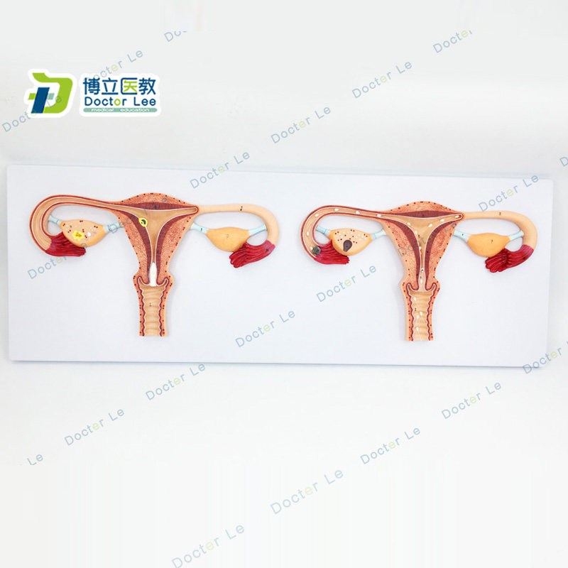 厂家正品直销卵子受精过程放大模型 女性卵子受精及卵.子发育输送