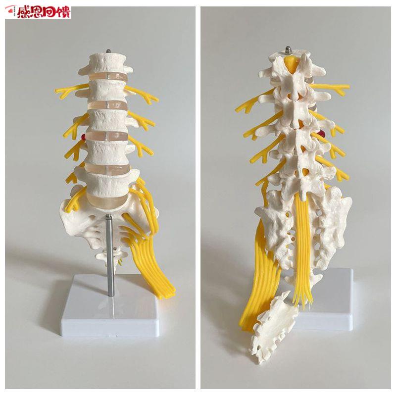成人1比1腰椎带骶骨椎间盘马尾坐骨神经中医N正骨推拿麻醉教学跨