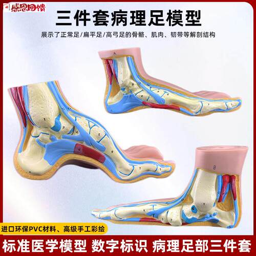 仿真人体脚足部解n剖模型正常病变足扁平足弓型足构结肌肉医学教