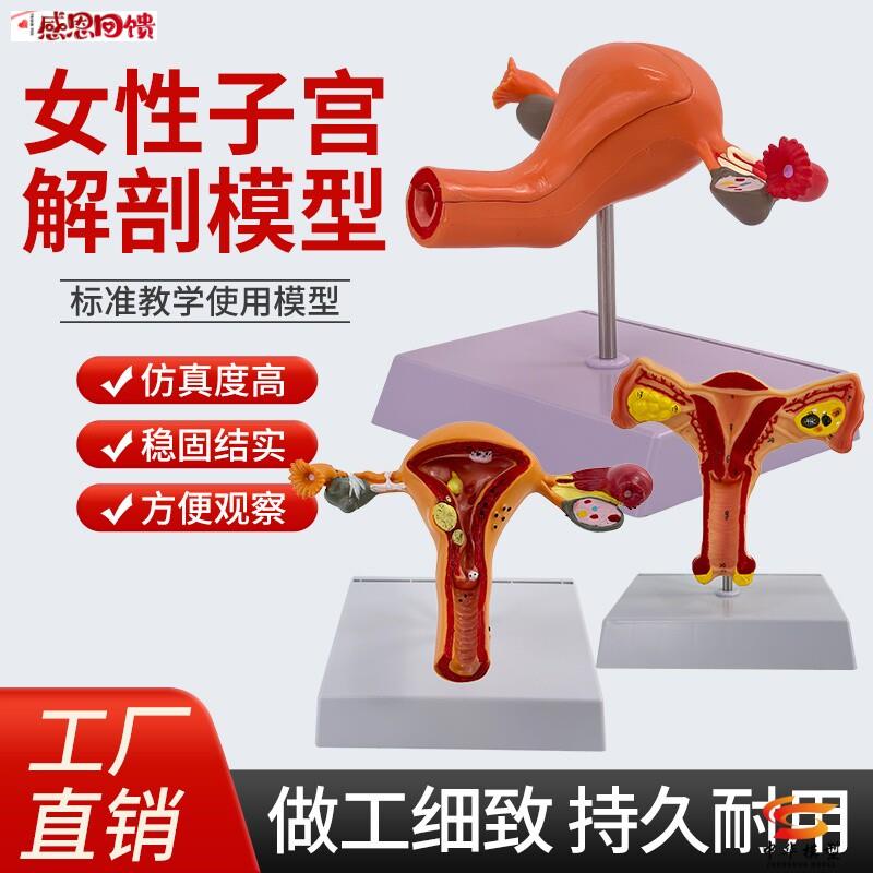 人体子宫模型教学模具阴道卵巢模型病P理变化科学教具女性生殖模