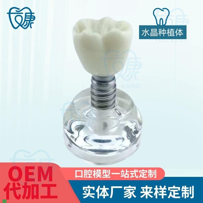 水晶种植体模型透明牙科模型教学医患沟通模O型诊室摆件齿科材料
