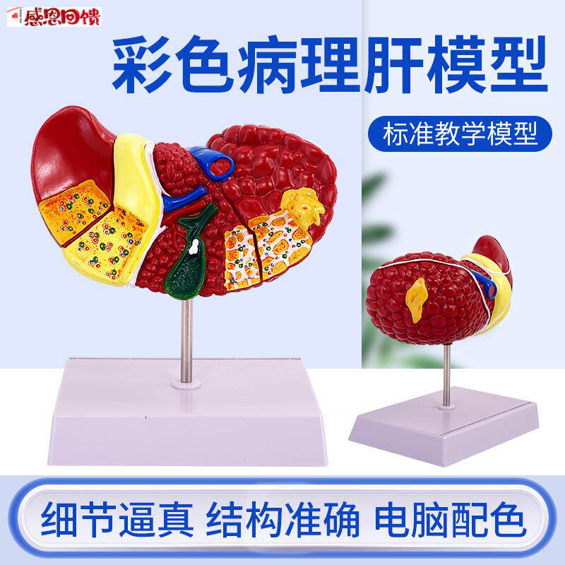 医学仿真人体肝脏解剖模型肝门胆囊胆管结构消化系统P器官演示教