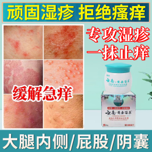 百草膏湿疹止痒去根大腿内侧皮肤阴囊瘙痒药男士隐私部位胯下抑菌