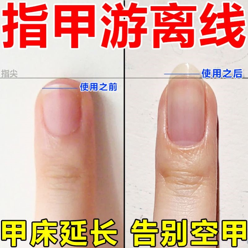 指甲游离线生长液护甲油增长液延长护理营养油养甲床分离空甲修覆