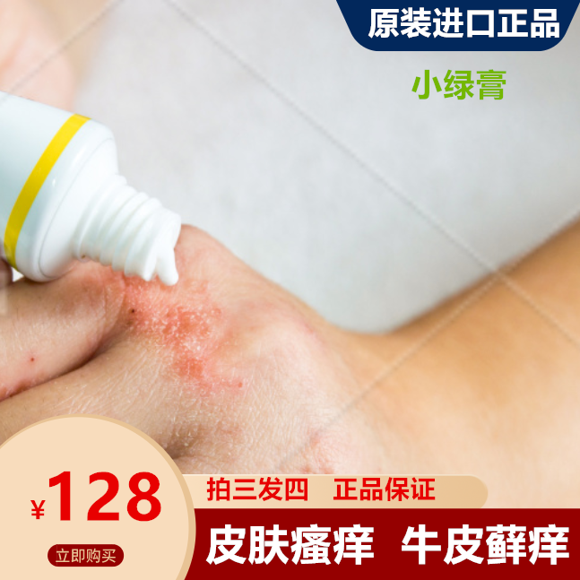 小绿膏止痒进口原装正品