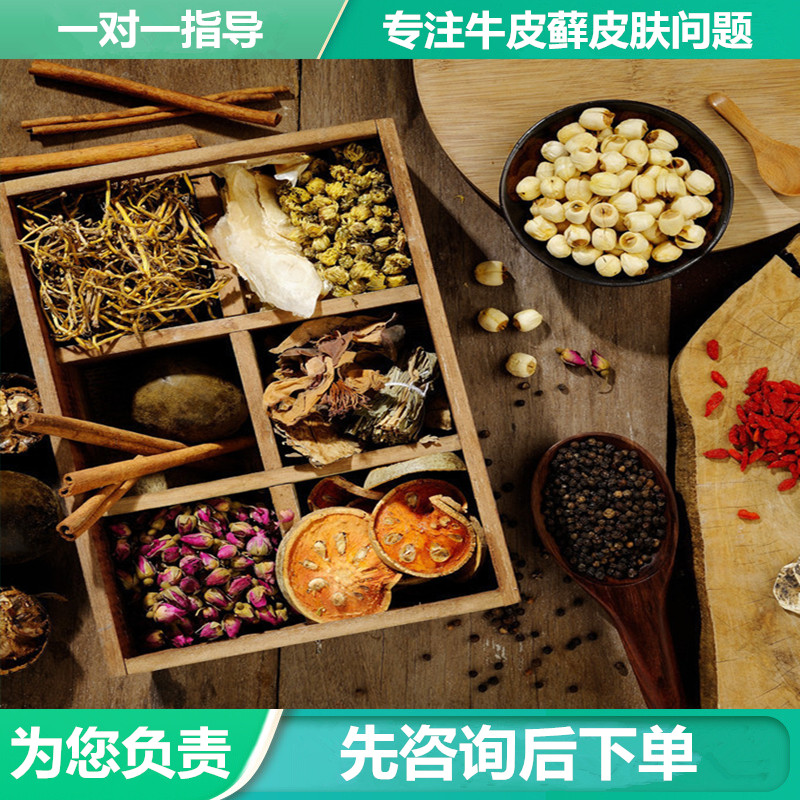 顽固型牛皮癣银屑病中药浴泡澡药包体股癣特效消银药水外用老偏方