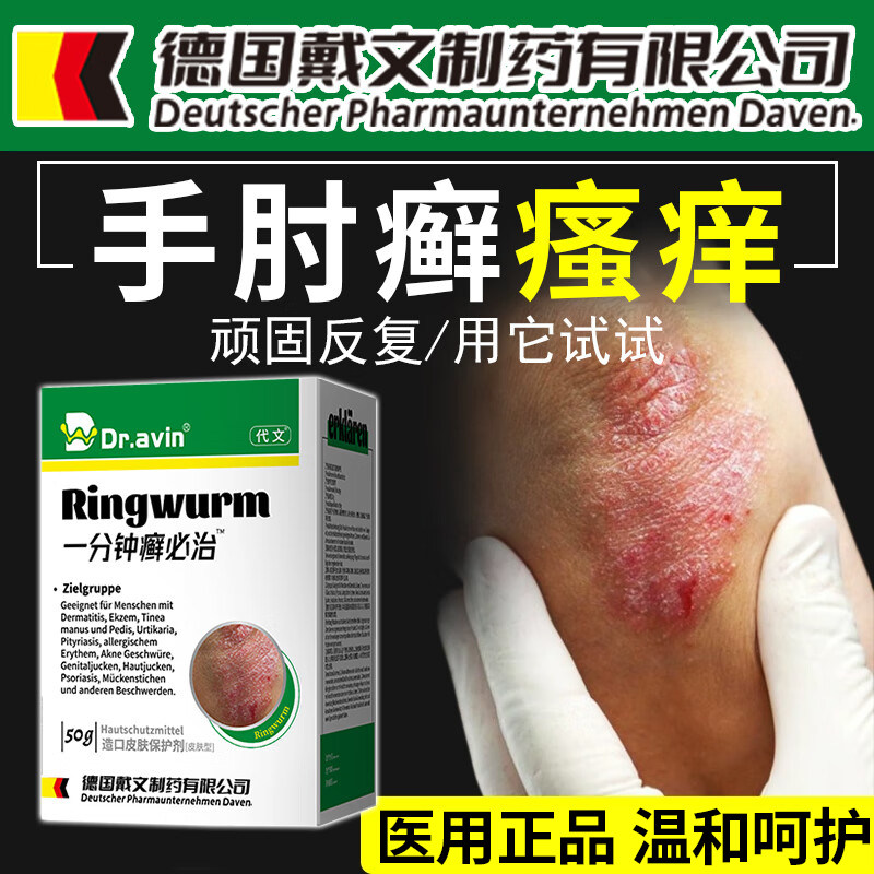 手肘癣瘙痒神经性皮炎顽固性皮癣手臂脱皮脱皮掉屑胳膊肘长癣膏qo