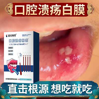 口腔溃疡疼痛白膜溃烂棉签棒