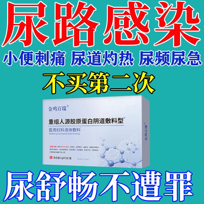 尿道炎女尿路感染尿频尿急外用小便次数多女尿道炎女尿路感染qo