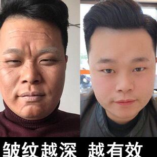 除皱纹神器去抬头纹祛皱男抗皱提拉紧致面霜男士去皱抗衰老护肤品