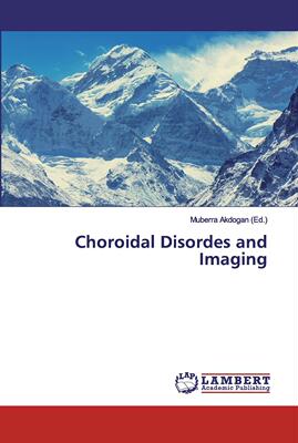 【预售 按需印刷】Choroidal Disordes and Imaging