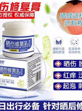 皮肤晒伤修复学生晒后修护脸部脖子泛红紫外线脱皮男女专用面霜乳