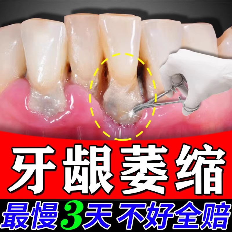 牙龈修复再生萎缩清洁牙粉牙齿松动特效药出血肿痛宽大健龈固齿散