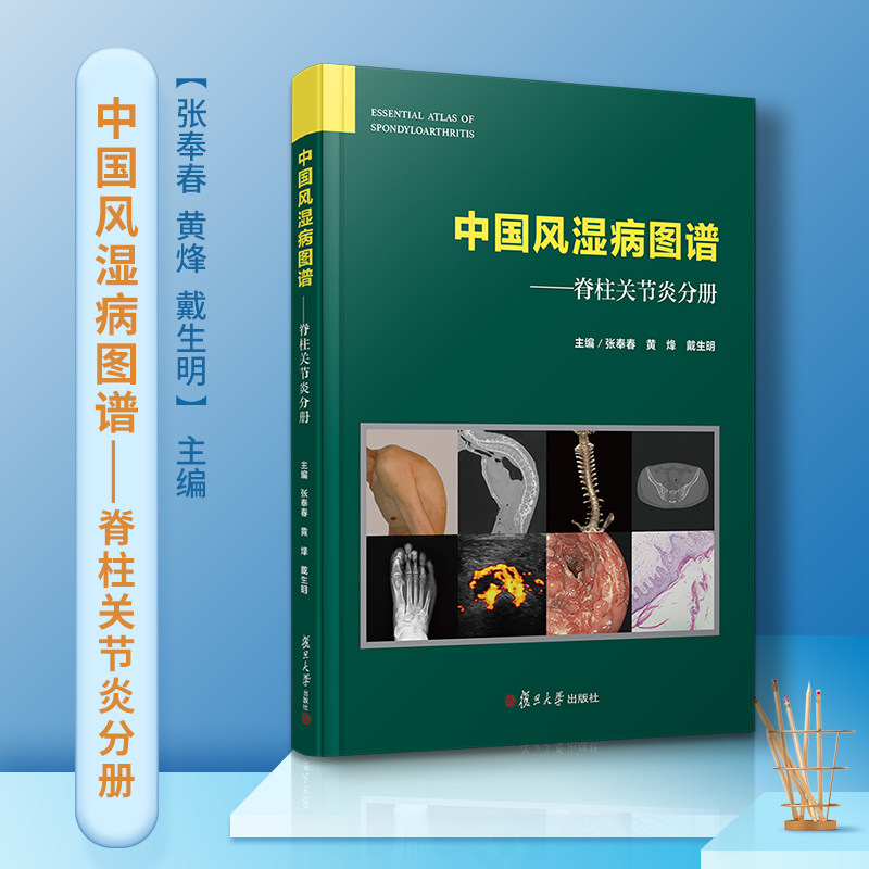 中国风湿病图谱:脊柱关节炎分册(中国风湿病图谱)