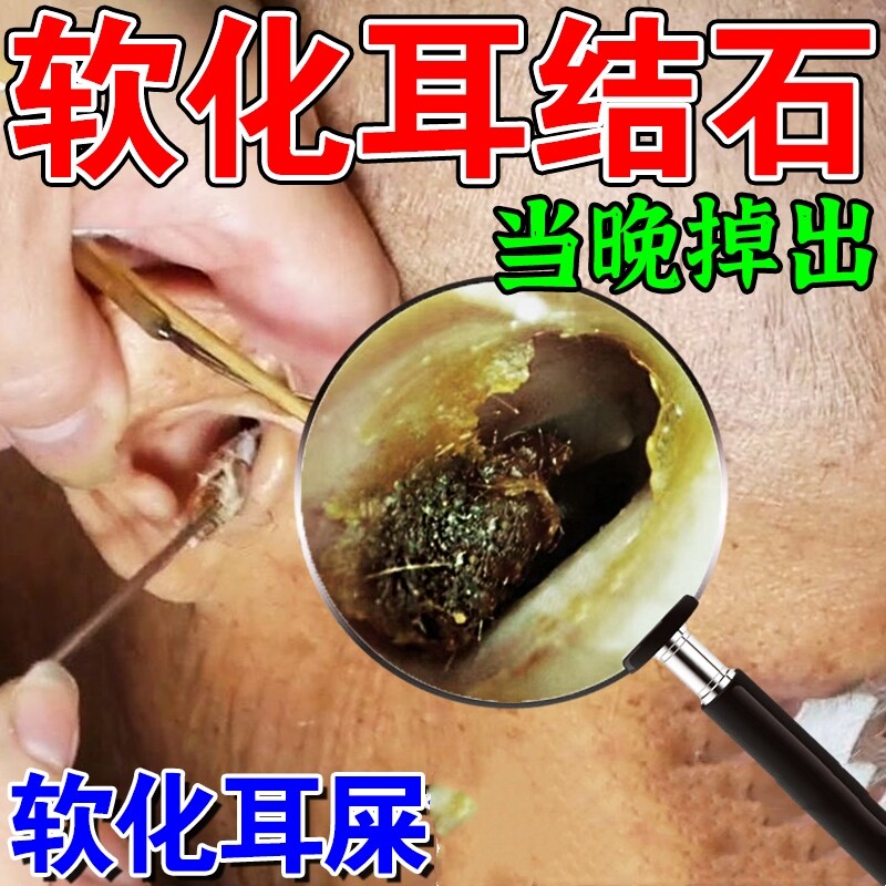 耳结石软化水取耳屎软化滴耳液治疗耳耵聍软化剂神器耳朵清洁药水
