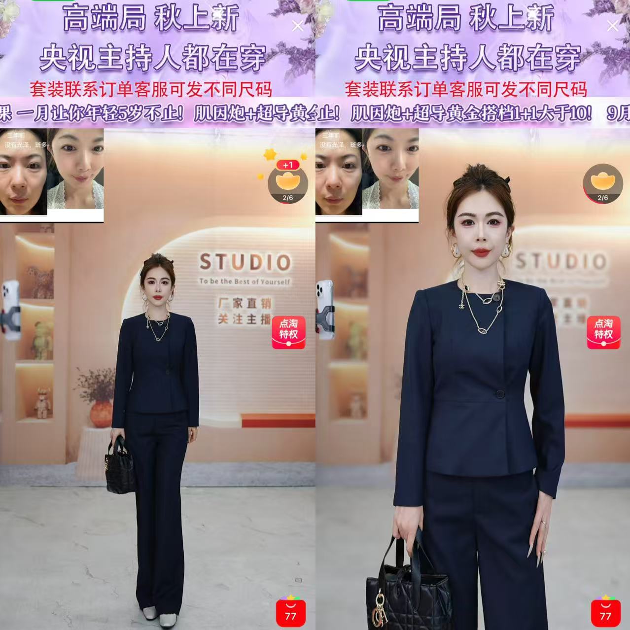 【芊芊粉丝专享】新款优雅女神范西装套装-GCP011