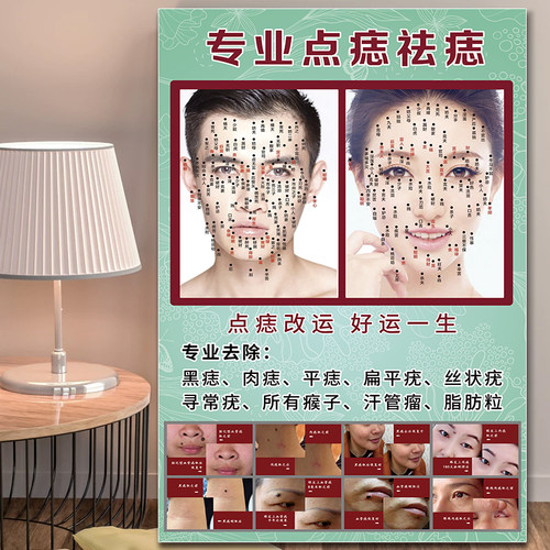 面部点痣图男女面痣痣相图装饰画