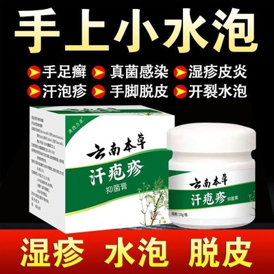 云南本草汗孢疹汗泡珍药膏专用汉状真菌感染手气手上起小水泡