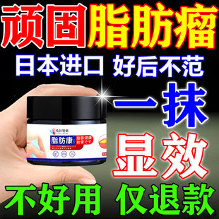 日本进口脂肪瘤消瘤膏效特药治疗肿块硬块皮下脂肪瘤鼓包除去神器