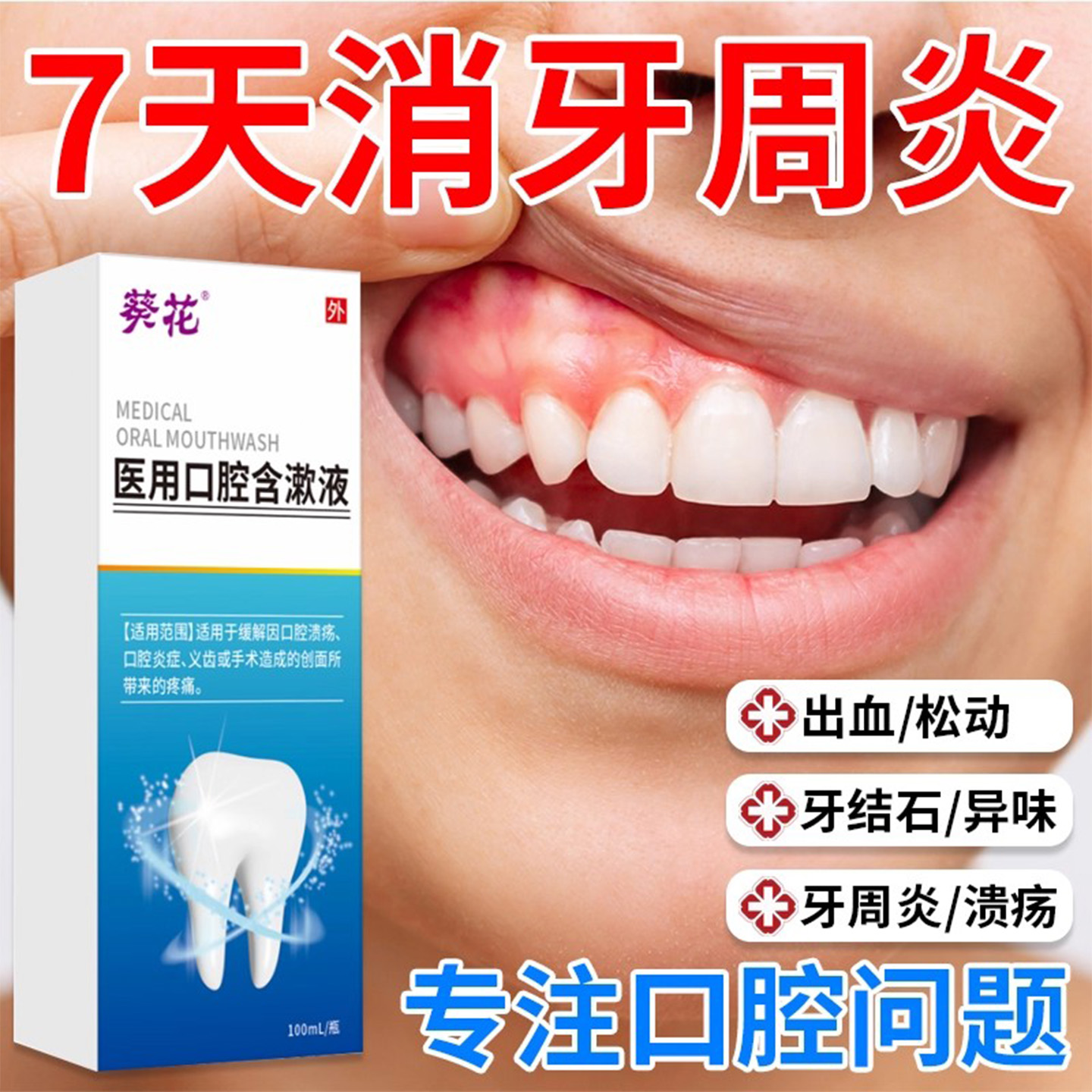 医用漱口水男女口腔牙周炎牙龈肿痛出血专用杀菌消炎除口臭专用gw