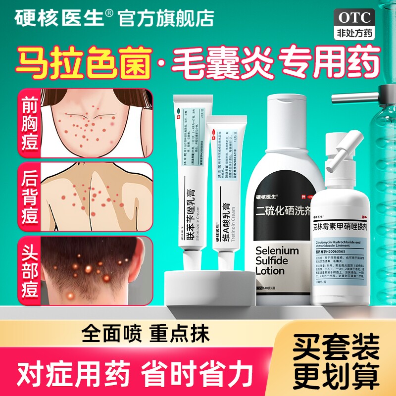 治疗马拉色菌毛囊炎前胸后背特断祛痘痘印药膏专用效喷雾剂洗发根