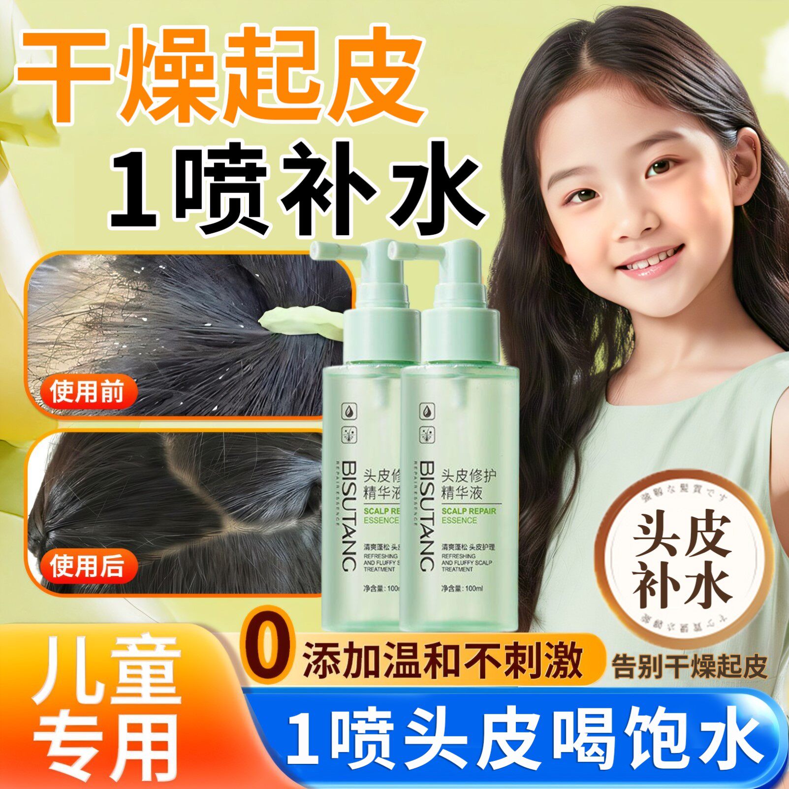 儿童头皮干燥起皮头屑多补水喷雾护理精华液毛囊营养液去屑止痒冬