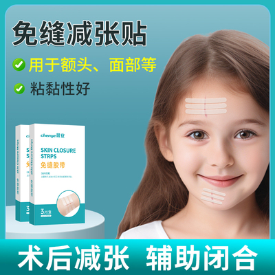免缝胶带儿童减张贴疤痕贴医用术后伤口皮肤辅助闭合免缝合减张器