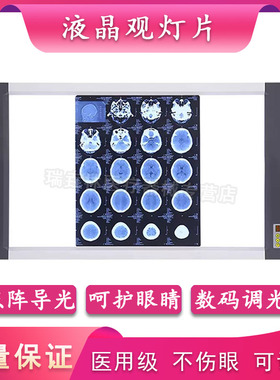 X光阅片灯CT核磁骨科看片灯led观片灯箱牙科双三联超薄医用观片灯