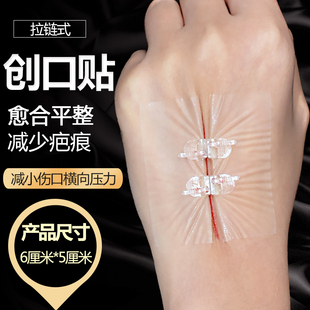 医用拉链式创口贴减张贴伤口拉合贴皮肤减张器吻合器免缝胶带敷贴