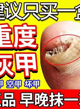 [金归]环吡酮胺乳膏1%*20g*1支/盒