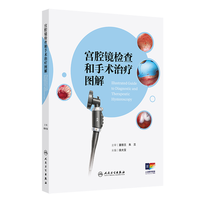 宫腔镜检查和手术治疗图解