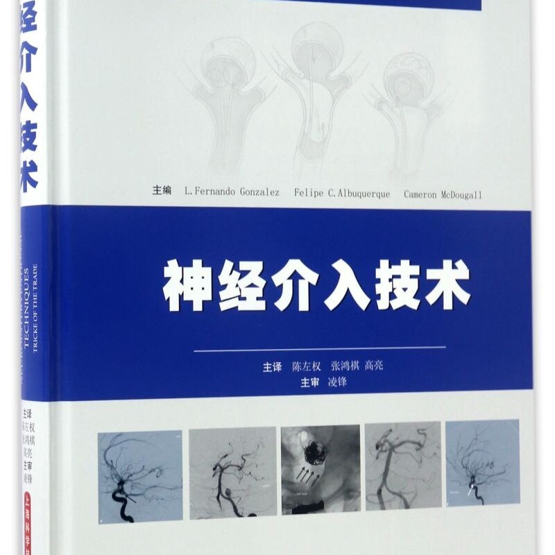 神经介入技术(精)