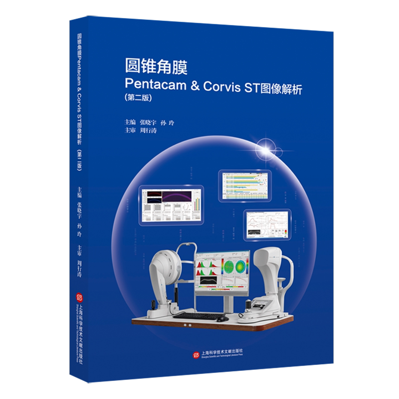 圆锥角膜Pentacam & Corvis ST图像解析