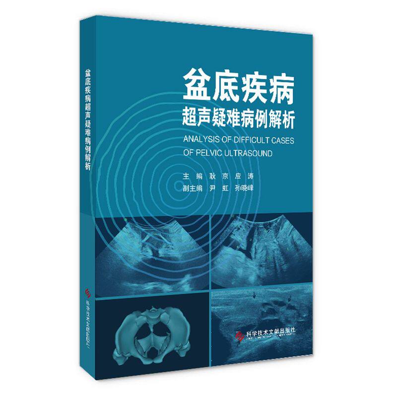 盆底疾病超声疑难病例解析使用感如何?