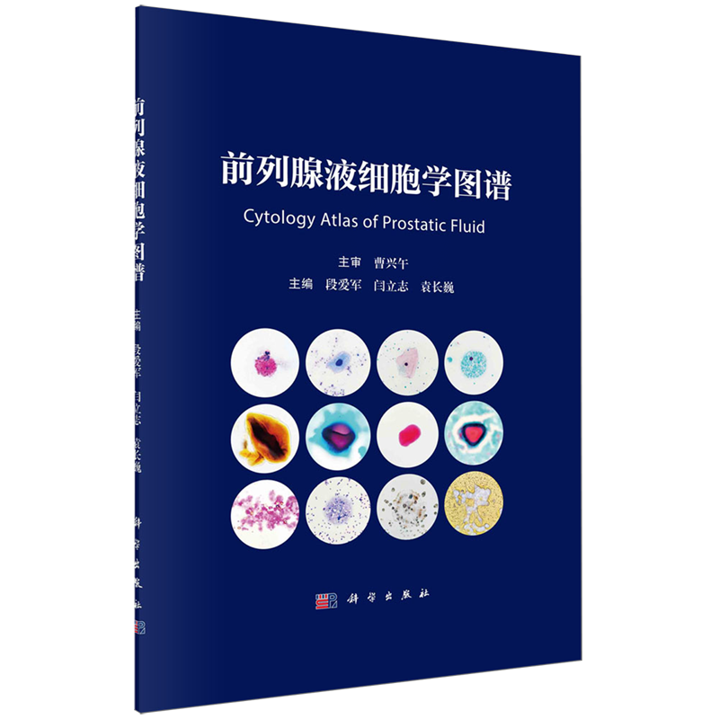 前列腺液细胞学图谱