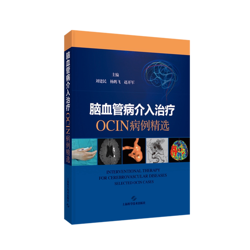 脑血管病介入治疗:OCIN病例精选