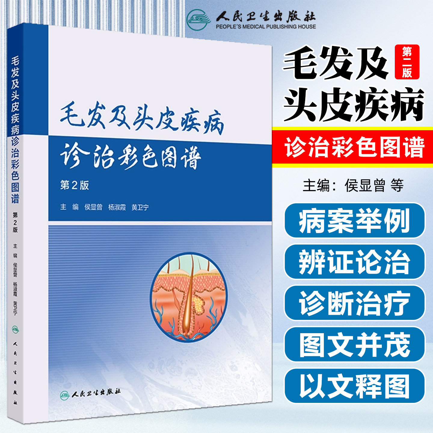 毛发及头皮疾病诊治彩色图谱 第2版 侯显曾 杨淑霞 黄卫宁 毛发头皮疾病的病理表现皮肤镜毛发镜等 人民卫生出版社 9787117377669