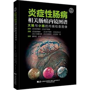 炎症性肠病相关肠癌内镜图谱:大肠与小肠的内镜检查图像
