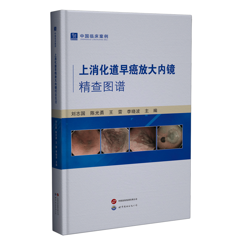 上消化道早癌放大内镜精查图谱