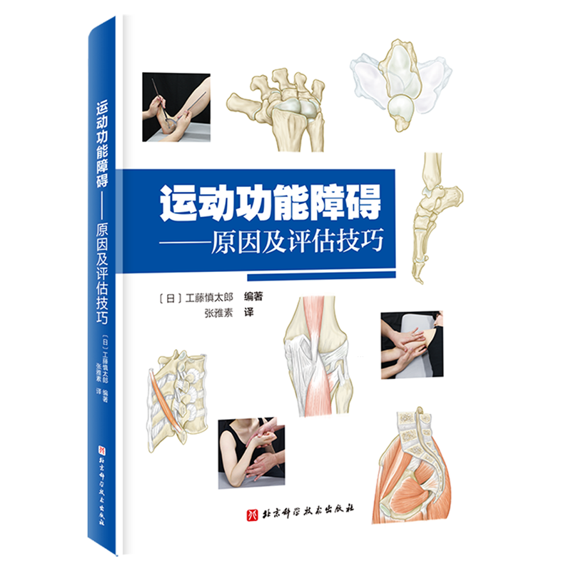 运动功能障碍:原因及评估技巧