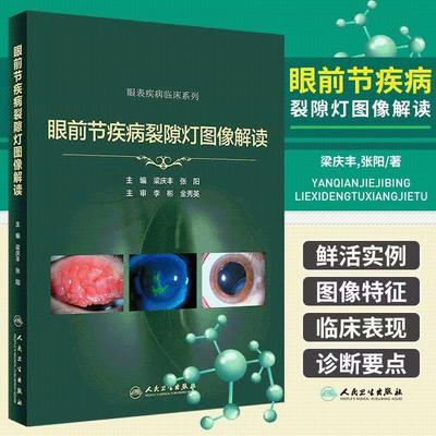 眼前节疾病裂隙灯图像解读实用学中华眼科特检照相技巧青光眼 角膜屈光手术并发症案例图解眼表疾病临床诊断视网膜人卫医学书籍
