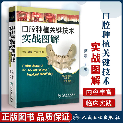 口腔种植关键技术实战图解 谭震主编 人民卫生出版社 精装 彩图版 供口腔医师研究生进修生用书口腔种植医学书籍医师临床用书