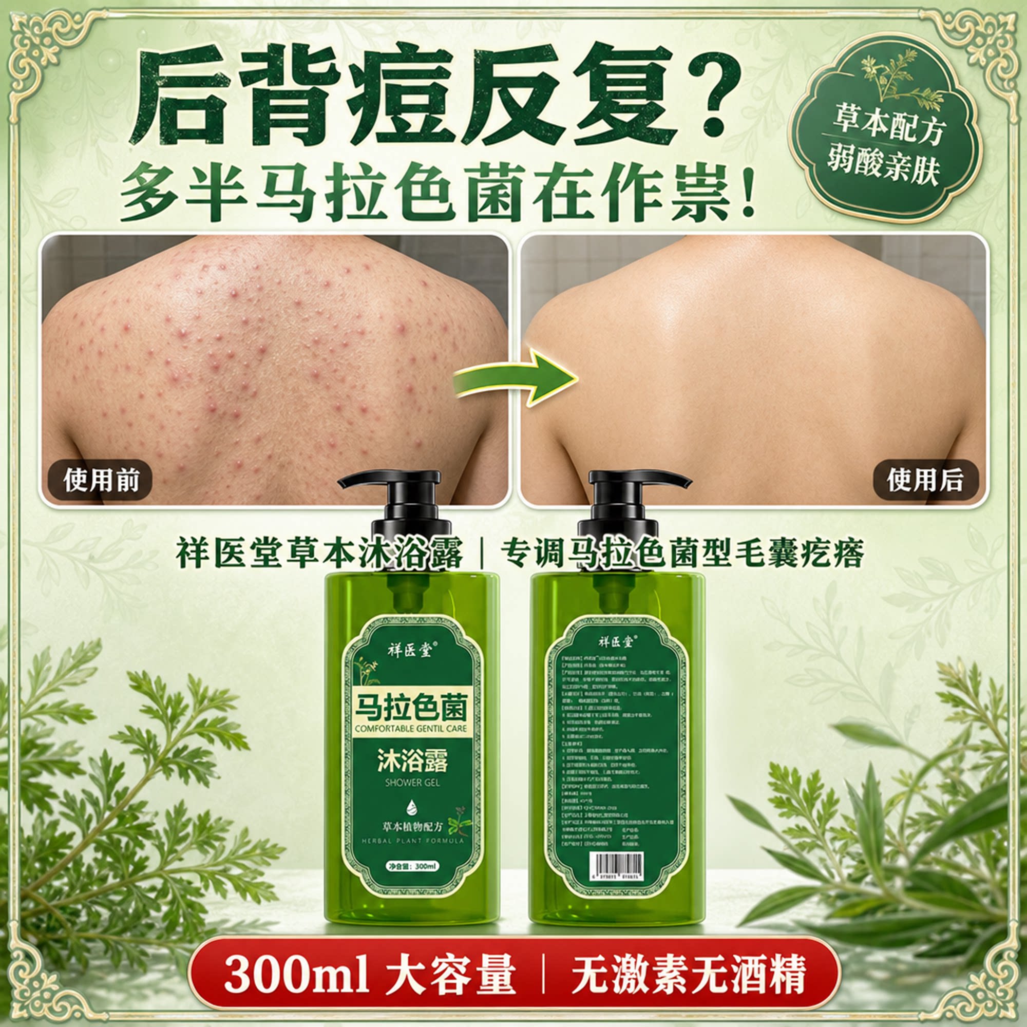 祥医堂马拉色菌沐浴露前胸后背部祛痘毛囊炎沐浴露专用官方旗舰店