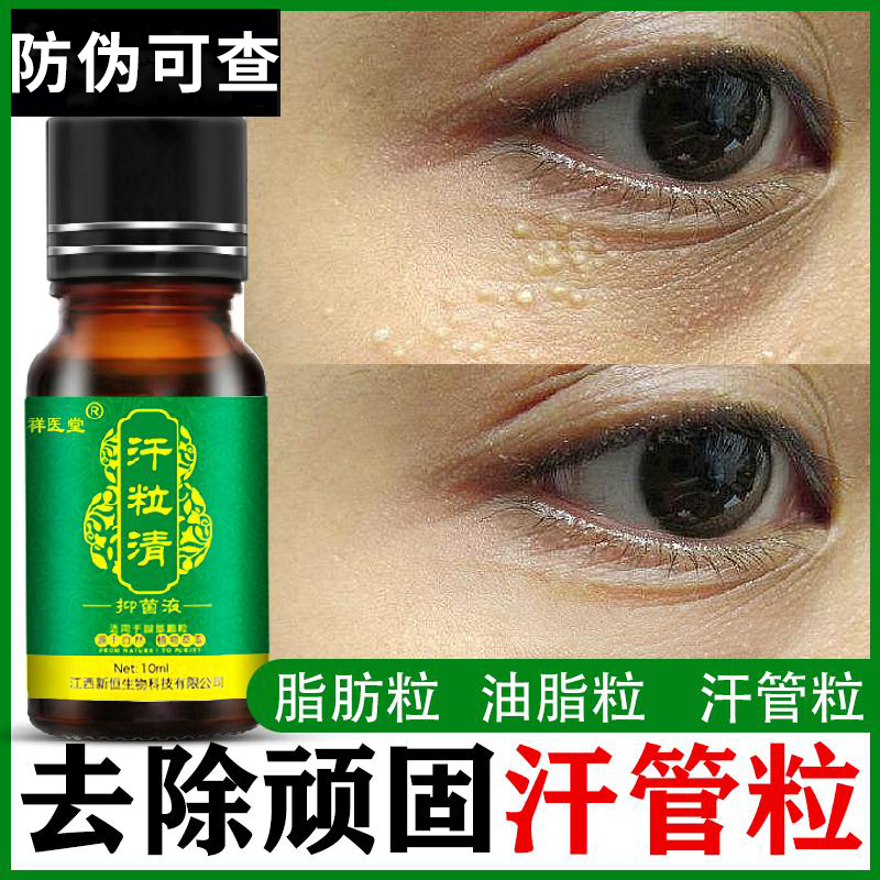 汗管瘤眼部去除脂肪粒