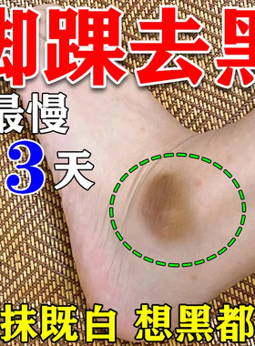脚踝发黑脚脖子去黑除腋下脖子指关节膝盖手肘黑色素沉淀白神器