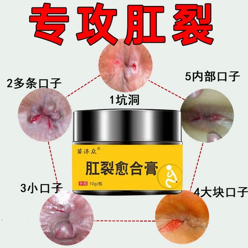 肛裂痔疮肛瘘大便出血瘙痒专用