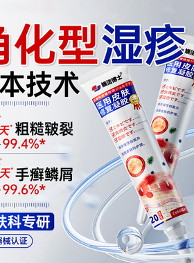 角化型湿疹鹅掌风手足癣膏手裂脱皮干裂痒真菌感染顽固皮炎专用bx